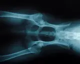 RTG miednicy psa z widocznym niedowładem tylnych łap. Widoczne kości miednicy i kończyn.