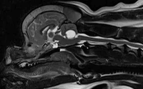 Przekrój MRI głowy i kręgosłupa psa, uwidaczniający jamistość rdzenia kręgowego.