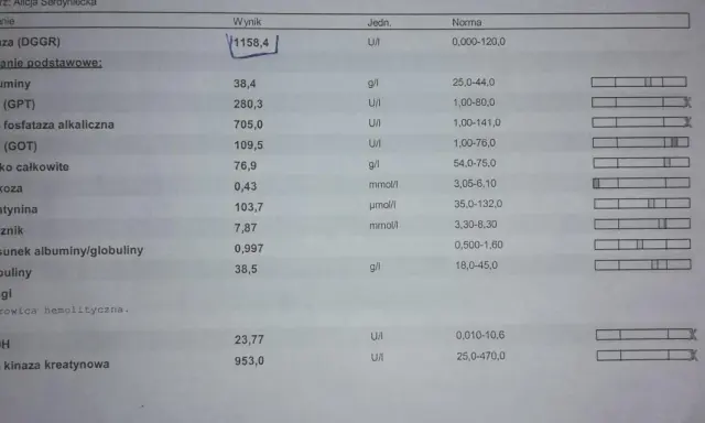 Wynik badania lipazy u psa: 1158,4 U/I. Wynik znacznie przekracza normę (0-120 U/I), co może wskazywać na problemy zdrowotne.